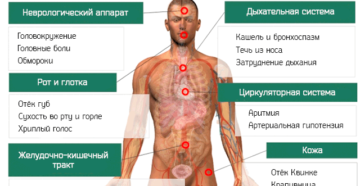 Симптомы болезней, Боли – М