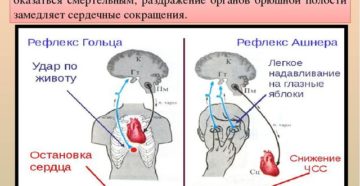 Сильно возбуждение