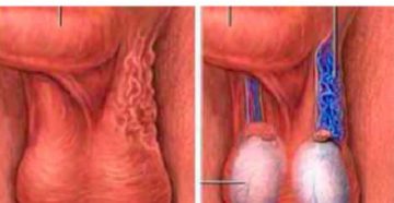 На мошонке стали просматриваться вены. Может из-за стресса?