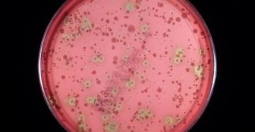 Streptococcus viridans