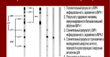 ПЦР в диагностике ВИЧ-инфекции
