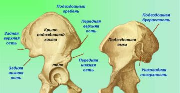 Эностоз крыла подвздошной кости справа