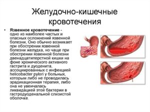 Желудочно-кишечные кровотечения