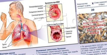 Боль в груди после бронхита