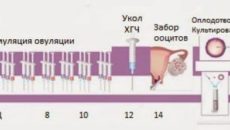 Длинный протокол ЭКО с 17 ДЦ?