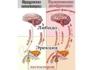 Диагностика импотенции (эректильной дисфункции)