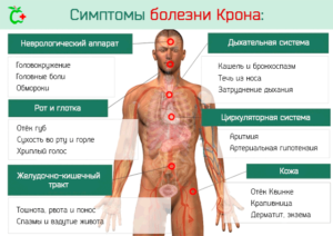 Симптомы болезней - Боли у детей и их причины от А до Я