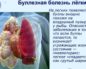 Буллезная болезнь легких