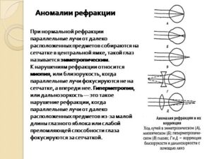 Хирургические способы коррекции аномалий рефракции (продолжение...)