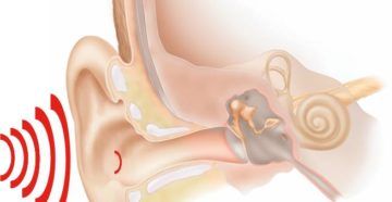 После гриппа правое ухо остро реагирует на звуки и громкую речь.