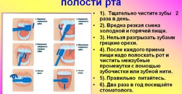 Здоровье полости рта: профилактика травм зубов и полости рта