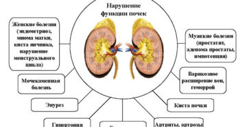 Симптомы болезни - нарушения функции почек