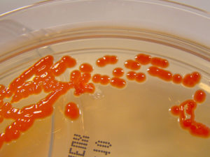 Serratia spp.