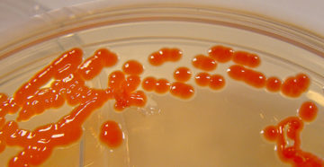 Serratia spp.