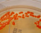 Serratia spp.