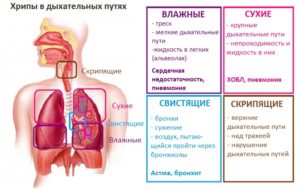 Хрип в легком