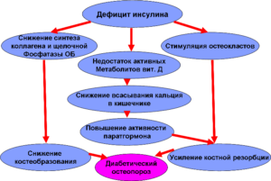 Диабет 1 типа остеопороз