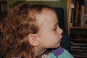 неравномерно растут волосы у ребенка.