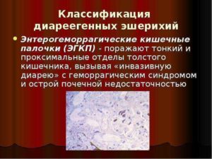 Энтерогеморрагические кишечные палочки (ЭГКП)