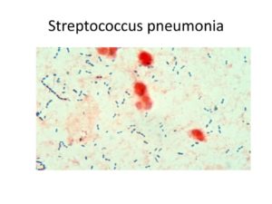 Стафилококк золотистый, стрептококк и клебсиелла пневмония