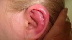Воспалительные заболевания наружного уха (продолжение...)