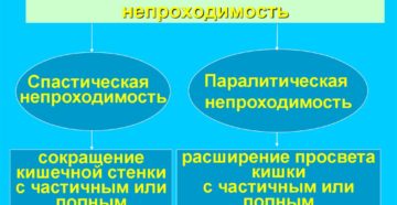 Динамическая непроходимость кишечника