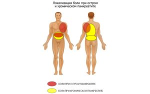 Симптомы болезни - боли во время панкреатита