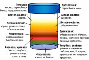 Темная моча: причины