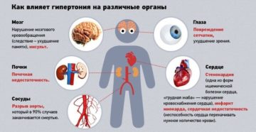 Гипертония: Высокое артериальное давление и заболевание глаз