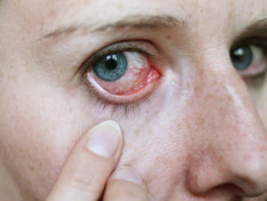 Симптомы болезни - боли в глазном яблоке