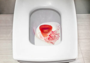 Кровь после похода в туалет