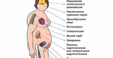 Симптомы болезни - нарушения гормонального баланса