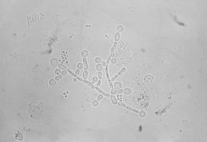 Mycoplasma genitalium и candida albicans