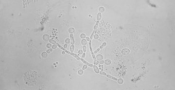 Mycoplasma genitalium и candida albicans