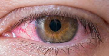 Паразитарные заболевания глазницы
