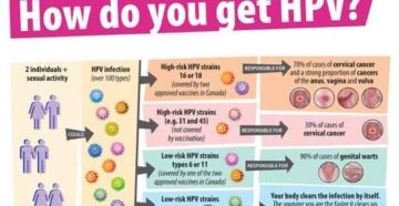 hpv-high risk