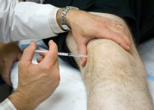Артрит: инъекции гиалуроната при остеоартрите коленного сустава