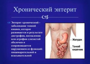 Симптомы болезни - нарушения функции кишечника