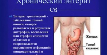 Симптомы болезни - нарушения функции кишечника