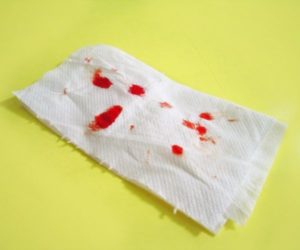 Кровяные выделения на туалетной бумаге