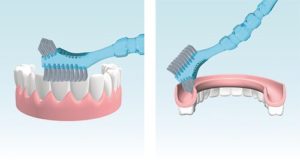 Уход за зубным протезом