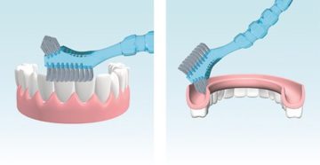 Уход за зубным протезом
