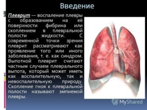 Воспалительные заболевания плевры