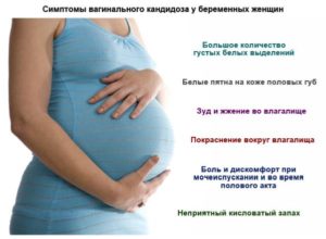 Беременность и кандидоз