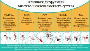 Дисфункция височно-нижнечелюстного сустава