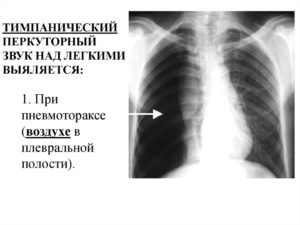 Непонятные звуки в легких