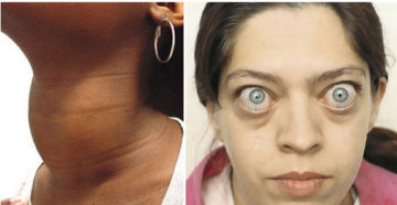 Симптомы болезней у женщин – Глаза