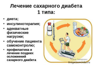 Сахарный диабет 1 типа: Обзор лечения