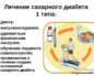 Сахарный диабет 1 типа: Обзор лечения