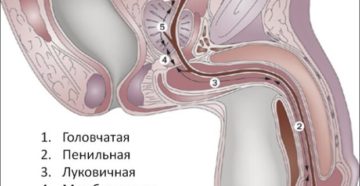 CСужение мочевого канала